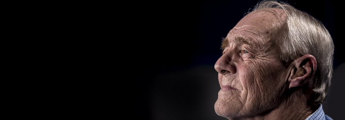 Dame visage avec rides et stress oxydatif